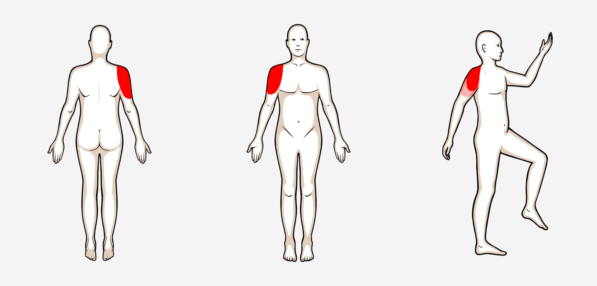 Dolor afilado y doloroso